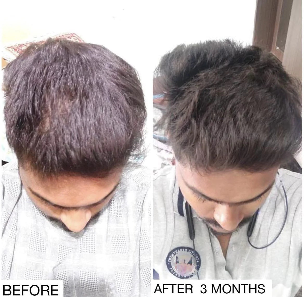 Nitya Sanjeevini Adivasi Herbal Hair Oil ✅👉